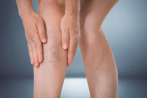 Czy lipofilling biustu się opłaca? Pełna analiza i porównanie