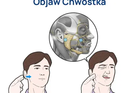 Tężyczka a nerwica: objawy psychiczne, diagnoza i leczenie