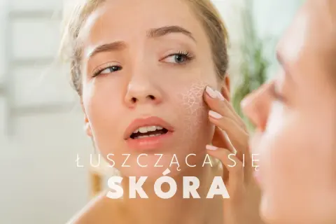 Kobieta z lekką łuszczycą na policzku dotyka swojej suchej, łuszczącej się skóry, patrząc w lustro.