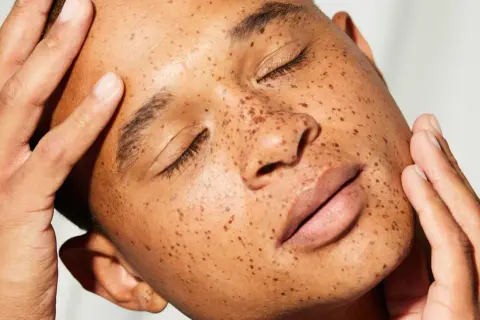 Rostro con pecas, piel radiante y manos acariciando la mejilla. El sebo natural de la piel, esencial para su salud.