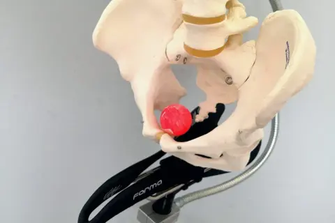 Modello anatomico del bacino su un supporto, con una sfera rossa posizionata per illustrare il dolore sellino bici.