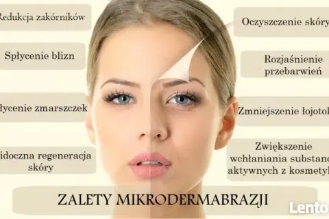 Mikrodermabrazja diamentowa: Jak odmienić skórę bez bólu?