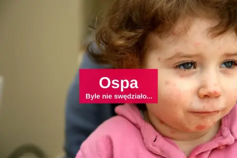Jakie leki na ospę u dzieci? Skuteczne metody łagodzenia objawów
