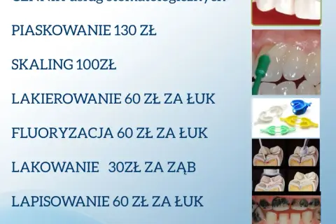 Ile kosztuje plomba u dentysty? Pełen cennik i porady eksperta