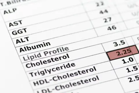 Wynik badania lipidogramu: trójglicerydy 1.5 mmol/l, co mieści się w normie u dorosłych.