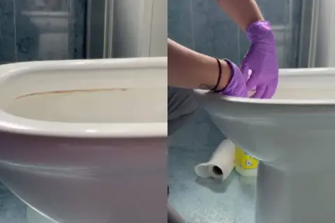 Manos con guantes morados limpiando el fondo del inodoro con sarro.