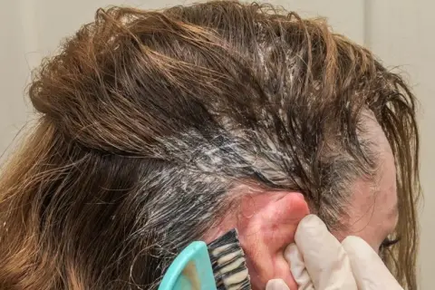 Aplicando producto para el cabello en la raíz. Si te manchas, así es como quitar el tinte de la piel.