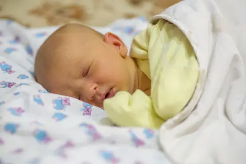 Bebé durmiendo con piel amarillenta, indicativo de bilirrubina alta en bebés.