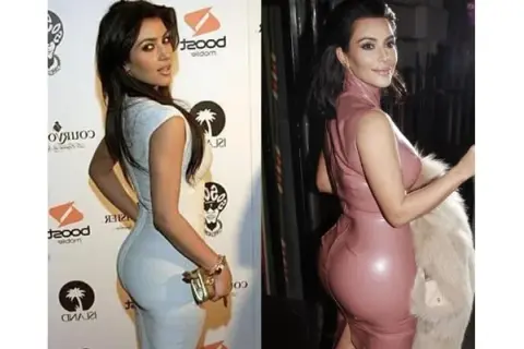 Kim Kardashian: Prawda o operacjach plastycznych i "efekcie BBL"