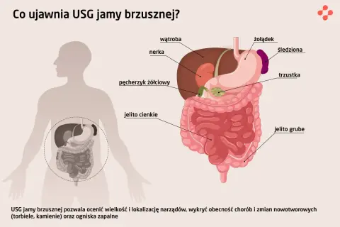 USG jamy brzusznej co wykrywa: wątrobę, nerki, żołądek, jelita, trzustkę, pęcherzyk żółciowy. Pomaga ocenić narządy i wykryć choroby.