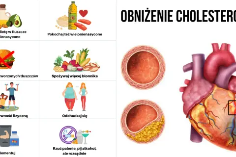 Czy cholesterol powoduje nadciśnienie? Odkryj niebezpieczne powiązania