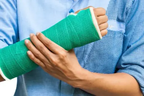 Złamana ręka – ile czasu trzeba nosić gips i co dalej?