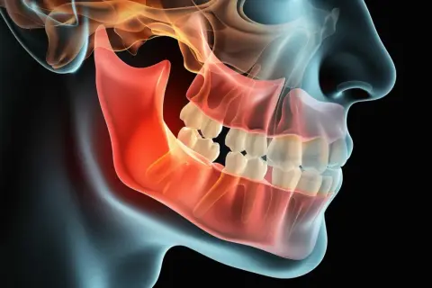 Anatomia szczęki z widocznymi zębami, w tym ósemkami. Wiele osób zmaga się z problemami z ósemkami.