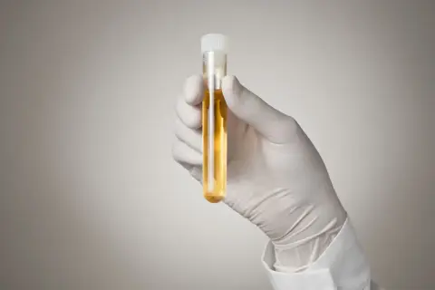 Jak skutecznie wykonać test na amfetaminę z moczu w domu?