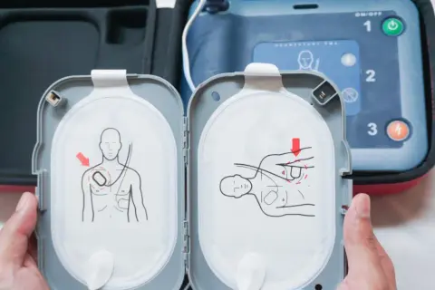Instrukcja użycia AED. Kiedy defibrylacja jest konieczna, elektrody umieszcza się na klatce piersiowej pacjenta zgodnie z rysunkami.