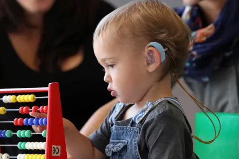 Niño con audífono jugando con ábaco, explorando la caja de los sentidos oido.