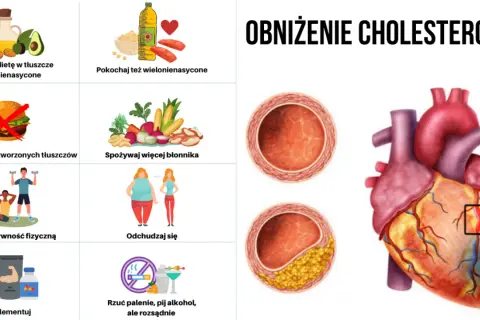 Jak obniżyć cholesterol w tydzień - proste sposoby na szybkie efekty