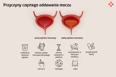 Ilustracja pokazuje przyczyny problemów z oddawaniem moczu u mężczyzn: nadmierne picie, choroby układu moczowo-płciowego, wiek, naświetlanie, leki, cukrzyca, nadwaga, ciąża.