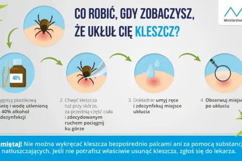Instrukcja usuwania kleszcza. Pamiętaj, że kleszcz może wejść do ucha, ale ta metoda pomoże go usunąć.