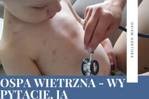 Kiedy po ospie do przedszkola? Sprawdź, kiedy dziecko może wrócić