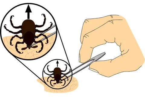 Cómo matar una garrapata de forma segura y evitar infecciones