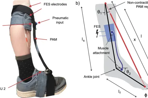 Sistema di elettrostimolazione per piede cadente con sensori IMU e attuatore PAM.