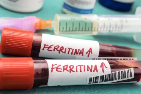 Dwie probówki z krwią oznaczone "Ferritina" i strzałką w górę, sugerującą podwyższony poziom, obok strzykawki.