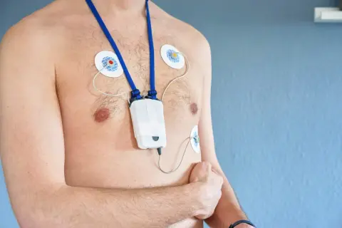 Mężczyzna z przyklejonymi elektrodami i urządzeniem holter ekg na klatce piersiowej, monitorującym pracę serca.
