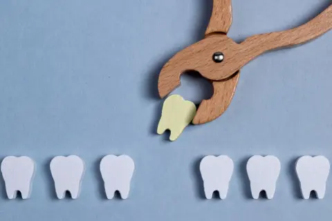 Pinze in legno estraggono un dente giallo da una fila di denti bianchi. Simboleggia la guarigione dopo l'estrazione del dente.
