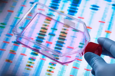 Badanie DNA w celu wykrycia mutacji genetycznych związanych z chorobą Pompego. Ręka w rękawiczce trzyma pojemnik z próbką na tle elektroforezy.