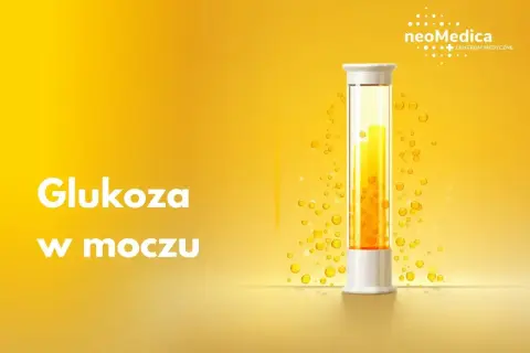 Badanie poziomu glukozy w moczu. Kolba z żółtym płynem i pęcherzykami, symbolizująca analizę.