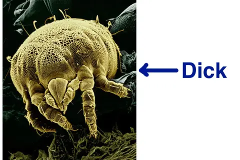 Microscopic view of a dust mite, a common allergen found in mattresses.