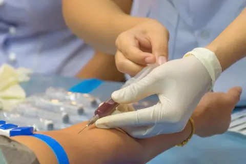 Zaburzenia hemostazy: objawy skaz krwotocznych i nadkrzepliwości