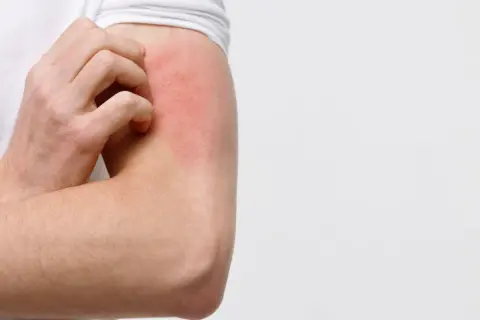 Juckende Haut am Arm, rot und gereizt. Was tun bei Hautjucken?