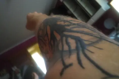 Ręka z tatuażem przypominającym korzenie drzewa. Skóra wydaje się blada, jakby brakowało osocza po tatuażu.