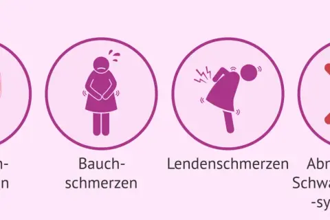 Anzeichen einer Fehlgeburt in der 17. SSW: Blutungen, Bauchschmerzen, Rückenschmerzen, Abnahme von Schwangerschaftssymptomen.