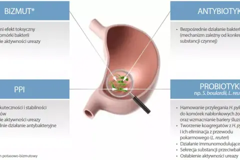 Skuteczne leki na helicobacter pylori - uniknij powikłań zdrowotnych