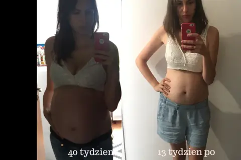 Czy biodra po porodzie się zejdą? Jak wrócić do formy i uniknąć zmian