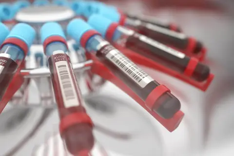 Probówki z krwią w wirówce laboratoryjnej. Wyniki badań wskazują na podwyższone bazocyty, co może wymagać dalszej diagnostyki.