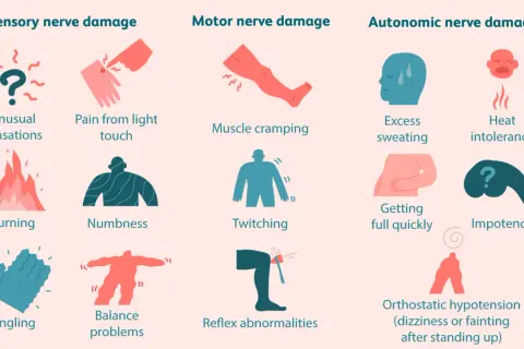 Danni ai nervi sensoriali, motori e autonomi, con sintomi come bruciore, intorpidimento, crampi, sudorazione eccessiva e problemi di equilibrio, possibili manifestazioni di neuropatia da stress.