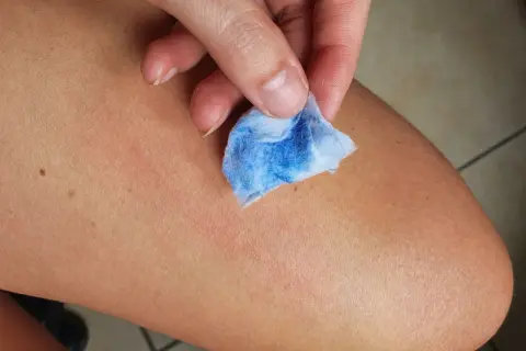 Mano che pulisce la pelle con un dischetto di cotone blu, mostrando come togliere la vernice dalla pelle in modo efficace.