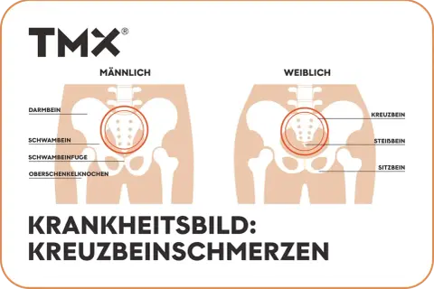 Vergleich männliches und weibliches Becken mit Hervorhebung des os sacrum. Illustration von Kreuzbeinschmerzen.