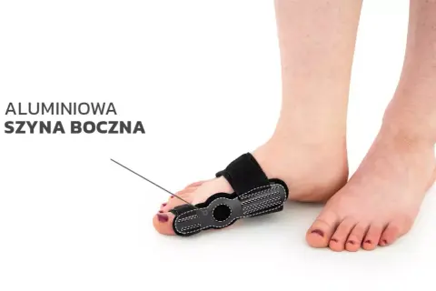 Najlepsza orteza na haluksy – wybierz skuteczne rozwiązanie dla siebie