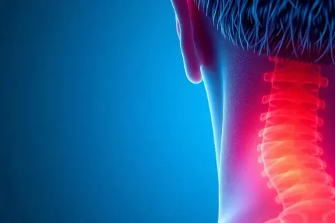 Schmerzhafte Myogelose im Nackenbereich, dargestellt durch rote Hitze entlang der Halswirbelsäule.