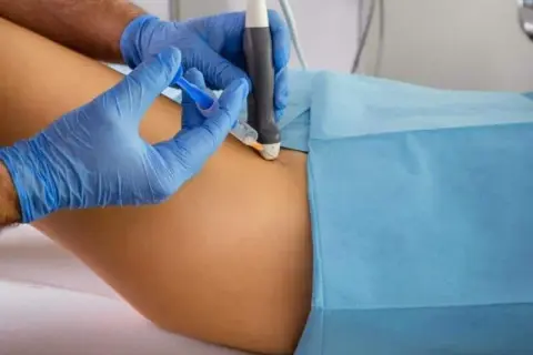 Czy to skręcenie biodra? Objawy, leczenie i kiedy do lekarza