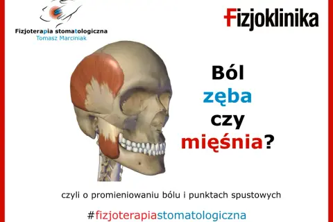 Model czaszki z zaznaczonym mięśniem żwaczem. Pytanie: Ból zęba czy mięśnia? Może to być ból dziąsła na końcu szczęki. #fizjoterapiastomatologiczna