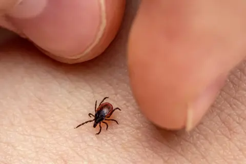 Garrapata marrón sobre piel humana, cerca de los dedos.