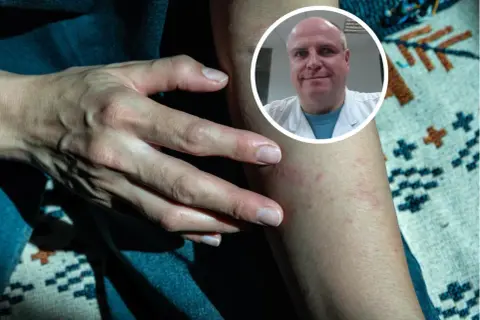 Dermatolog czy onkolog? Gdzie iść z niepokojącym znamieniem?
