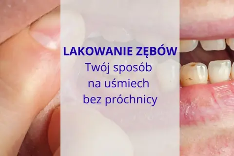 Jak skutecznie zapobiec próchnicy? Odkryj sekrety dentysty!