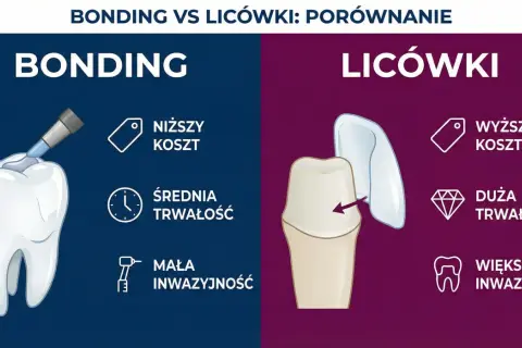 Porównanie metod poprawy uśmiechu: bonding (niższy koszt, mała inwazyjność) vs. licówki (wyższy koszt, większa inwazyjność). Jak wyprostować zęby bez aparatu?